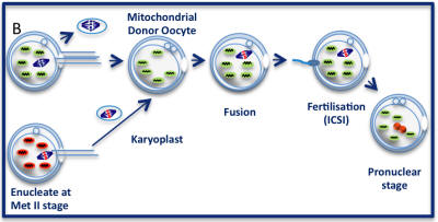 Mitochondrial Spindle transfer