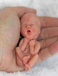 Fetus