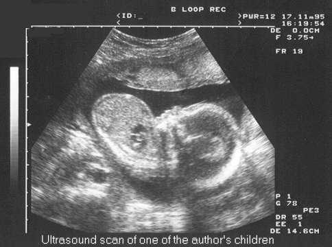 Ultrasound image